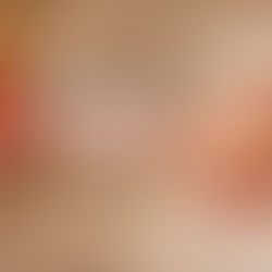 What Are the Benefits of Red Coral?