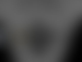 Cervical spine x-ray of pediatric patient