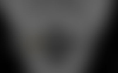 Cervical spine x-ray of pediatric patient