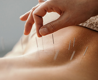Acupuncture for Cancer Pain at OAHU Acupuncture Clinic by Honolulu Licensed Acupuncturist
