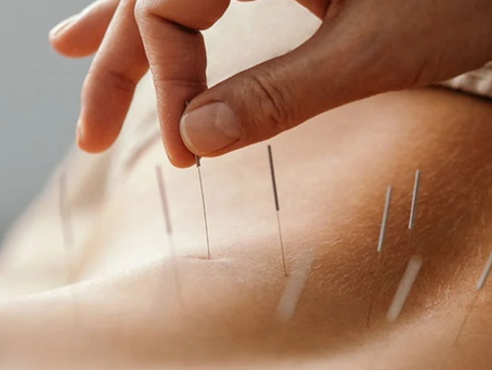 OAHU Acupuncture Clinic Traditional Chinese Medicine Clinic Acupuncture Treatment Haleiwa 96712 Patients Honolulu Licensed Acupuncturist Dr. Annie Yang 杨