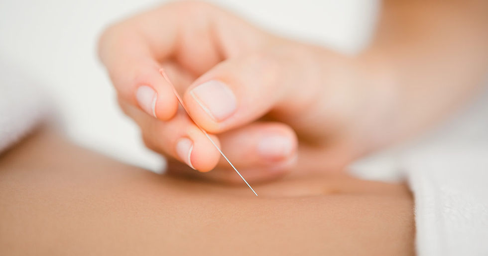 'AIEA 96701 OAHU Acupuncture Clinic Acupuncture Treatment for Allergies Licensed Acupuncturist Dr. Annie Yang 杨 Honolulu Traditional Chinese Medicine HAWAII Central Earth Acupuncture, Cupping & Chinese Herbs Call: 808-582-8660