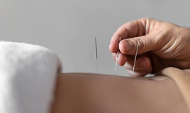 close-up-hand-holding-acupuncture-needle