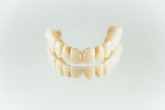 ZahnStyle | Dentallabor - Leistungen Vollverblendete Zirkon Kronen