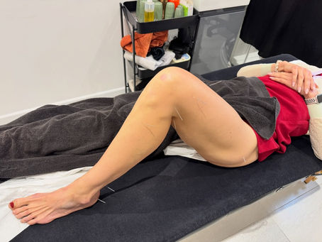 Why your knee pain might actually be a hip problem