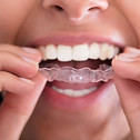 dental-night-guard.jpeg