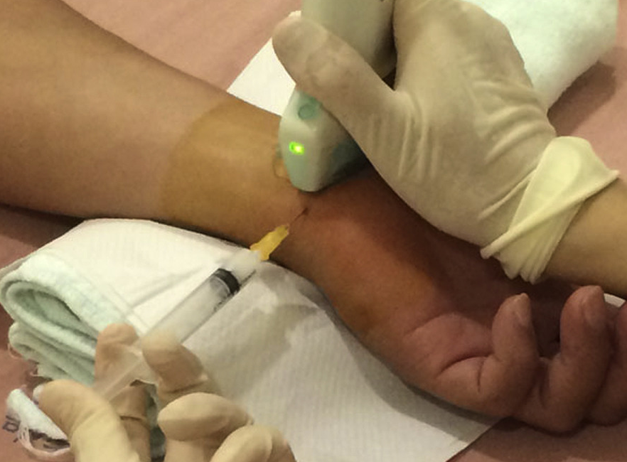 Ultrasound Guided Carpal Tunnel Injection