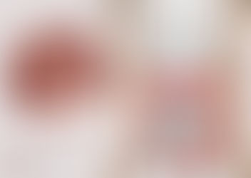 Doença diverticular: quando é preciso fazer cirurgia?