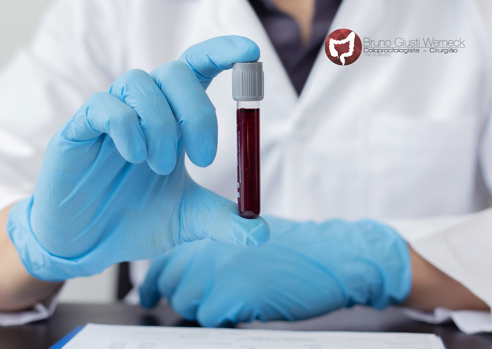 Exames laboratoriais ajudam no diagnóstico de doenças inflamatórias intestinais