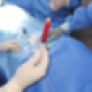 Tratamento com células-tronco mesenquimais para fístulas complexas