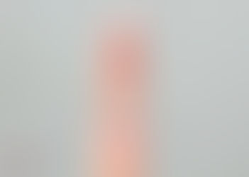 Fissura anal e hemorroidas: como diferenciar os dois problemas?