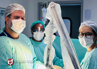 Tratamento de fístula anal a laser