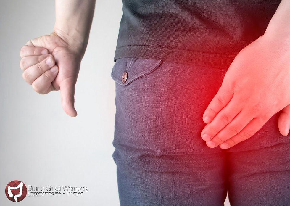 Cisto pilonidal: qual é o melhor tratamento?