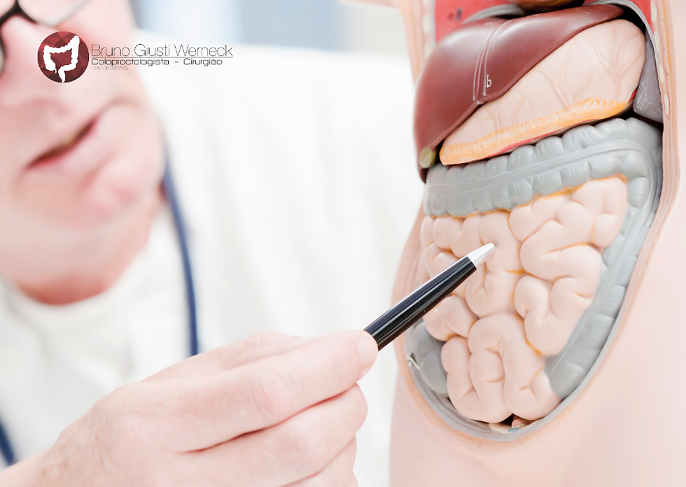 Diverticulite recorrente: por que cada vez mais pessoas têm isso?