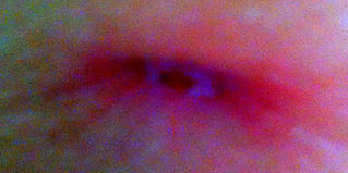 Peeping through skin