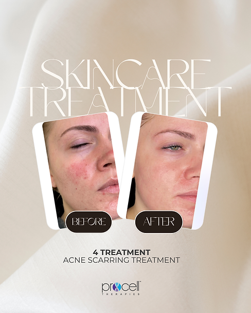 Beige Grey Classy Skincare Product Promotion Carousel Instagram Post.zip - 6.png