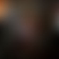 Gingivitis