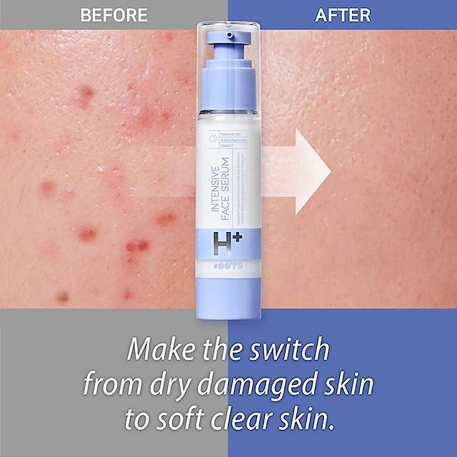 Soft Clear Skin