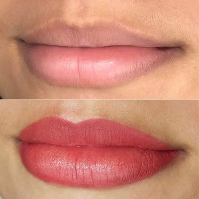 micro labial