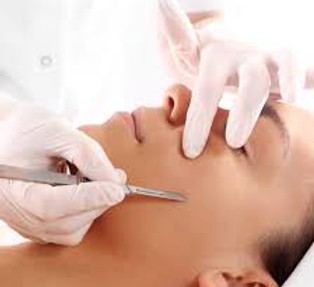 Dermaplaning.jpeg