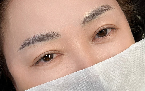 항암 후 눈썹모가 일부 유실된 경우 눈썹 반영구 시술 전후