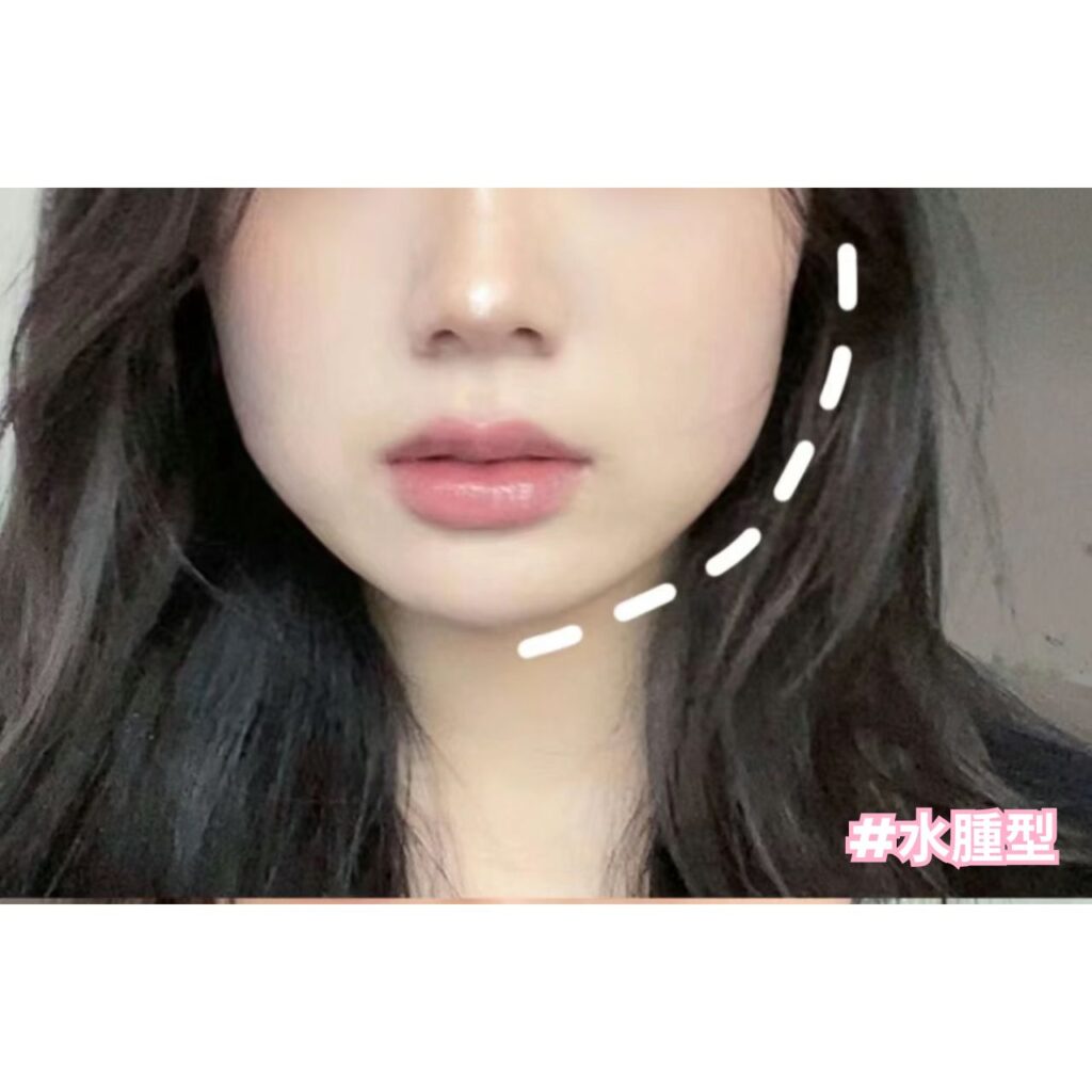 MIN Boutique _ 52818751_旺角_銅鑼灣_尖沙咀_觀塘_將軍澳_天水圍_層層疊 _抗衰老_透明質酸_膠原蛋白_皺紋_法令紋_毛孔_DEP無針注射_DEP_意大利DEP_DEP療程_A醇_瘦小臉_ botox副作用_ botox_國字臉_無針注射_facial_Facial 香港_香港_皮膚管理_facial旺角_facial銅鑼灣_facial尖沙咀_facial觀塘_ facial將軍澳_ facial天水圍