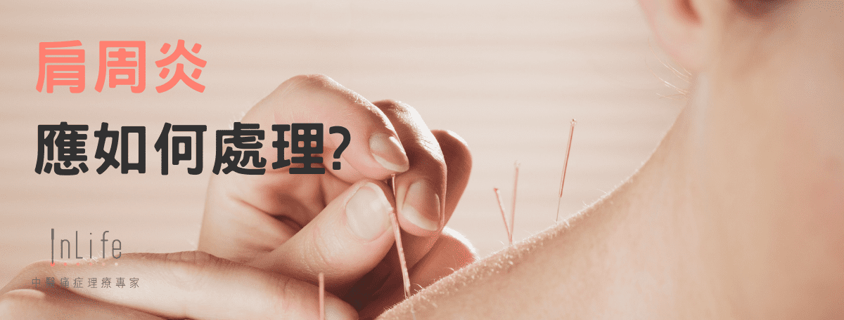 肩周炎的中西治療方法