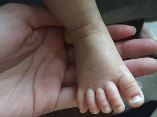 【KOL產後減肥推介】產後消脂修腰緊緻護理 找回少女身材!