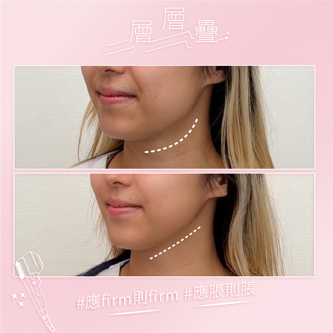 B&A_2
