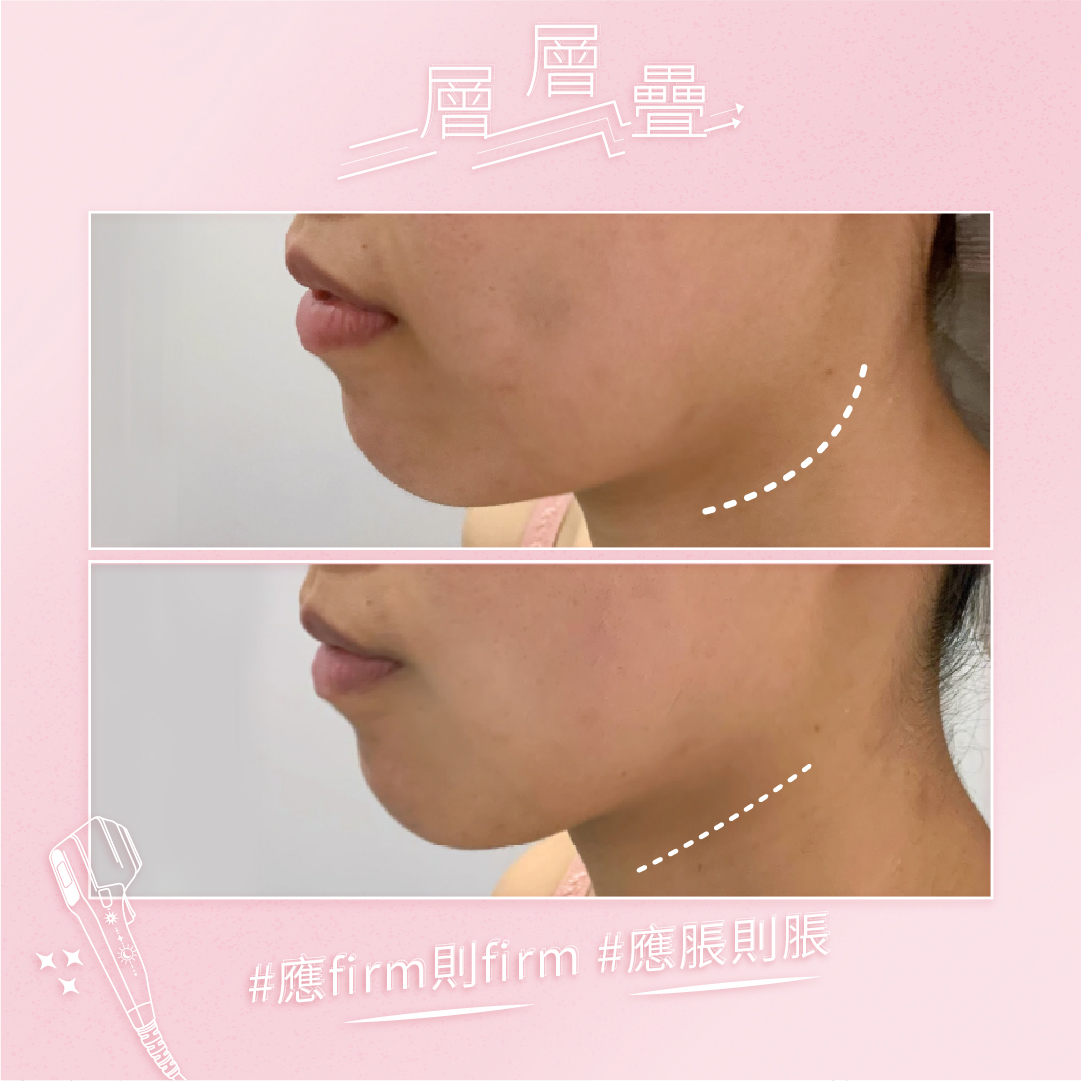 B&A_4