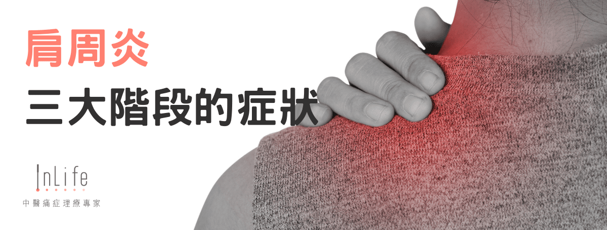 肩周炎三大階段的症狀