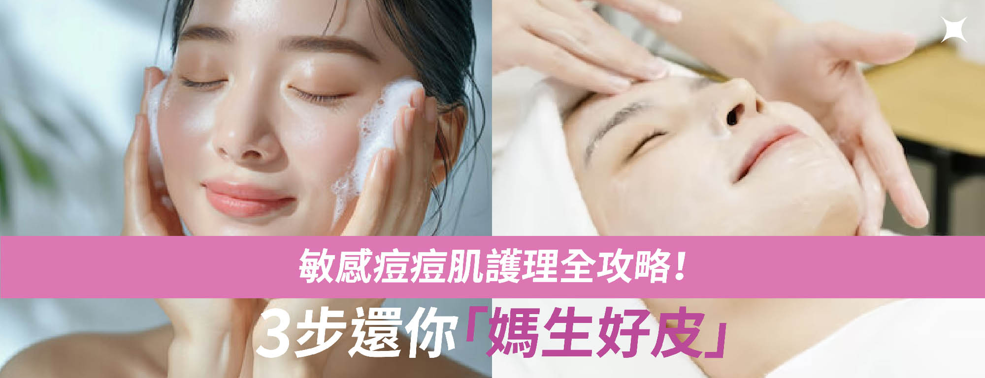 敏感痘痘肌護理