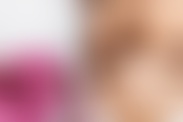 What Is Dermapen Treatment for Healthier Looking Skin?