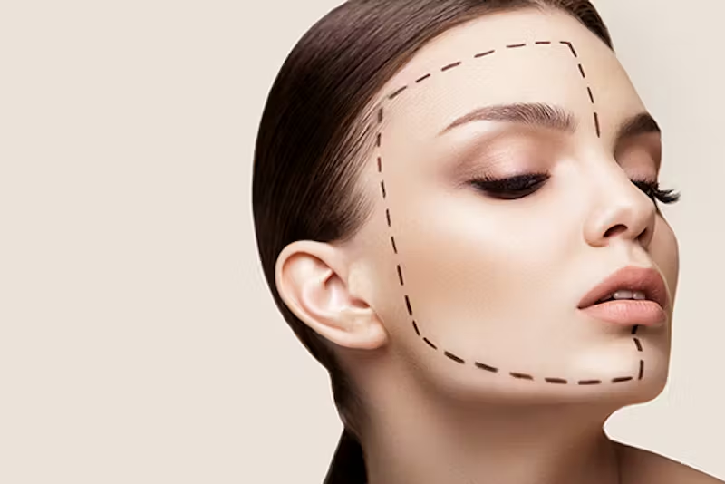 Is Jawline Contouring Suitable for Face Balance