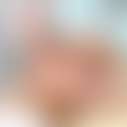 Is Electrolysis Hair Removal Permanent?