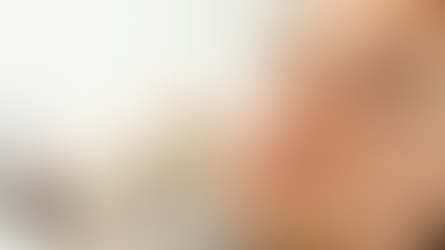 What Cosmetic Injection Options Exist?