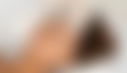 What Are the Different Face Rejuvenation Methods?