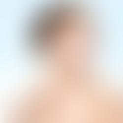 What Is the Process of Neck Lift Surgery?