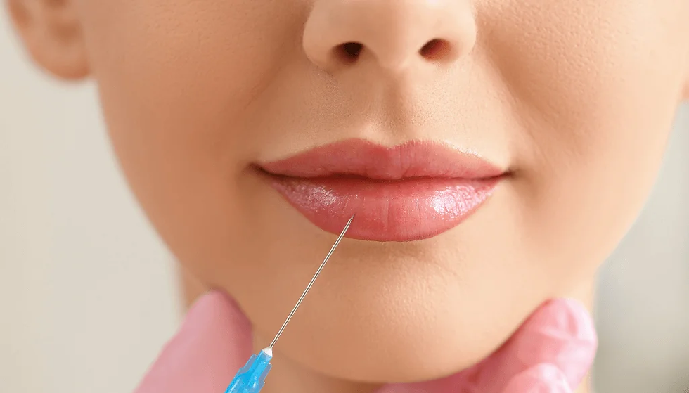 How Do You Achieve The Best Russian Lip Fillers Look?