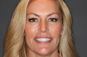 Bridget before and after1.jpg