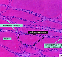 TIREOIDE