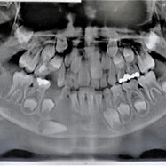 20181024_093807 editado.jpg