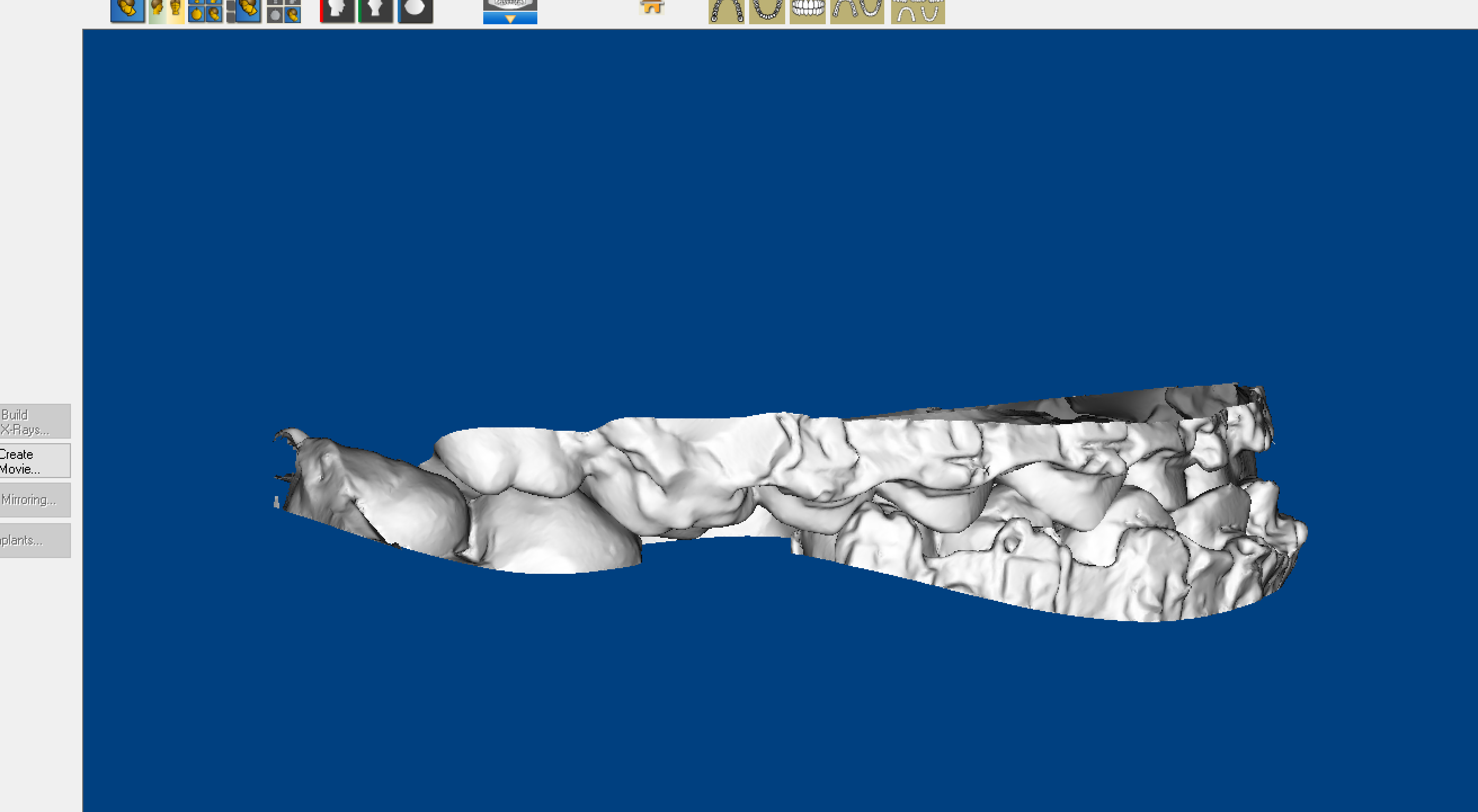 Cad CAM iNTRA Oral para cirugía