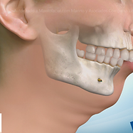 clase 2 ortognatica.png