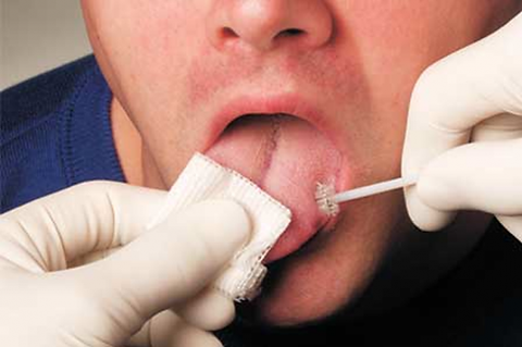 taking biopsy