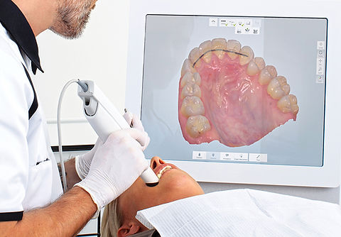 intra oral dental scanner.jpg