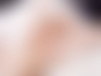 Why Professional Skin Analysis Matters More Than You Think