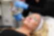 MicroLaserPeel®.jpeg