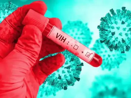 Un promedio de 4,000 casos positivos al virus del (VIH) Sida son reportados cada año en RD