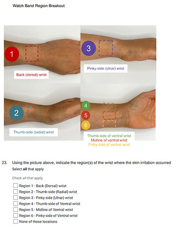 wrist-worn, smart watch, fitness tracker, skin sensor, skin irritation questionnaire, skin irritation survey, contact dermatitis questionnaire, contact dermatitis survey, ACD, ICD, allergic contact dermatitis, dermatology, dermatologist, location, distribution, watch band, watch strap, nickel allergy, watch plug, metal plug, buckle, quick buckle, doral, ventral, radial, ulnar wrist, watch band region breakout
